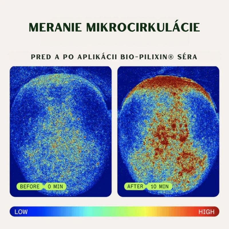 Bio-Pilixin® Hairline Booster 3